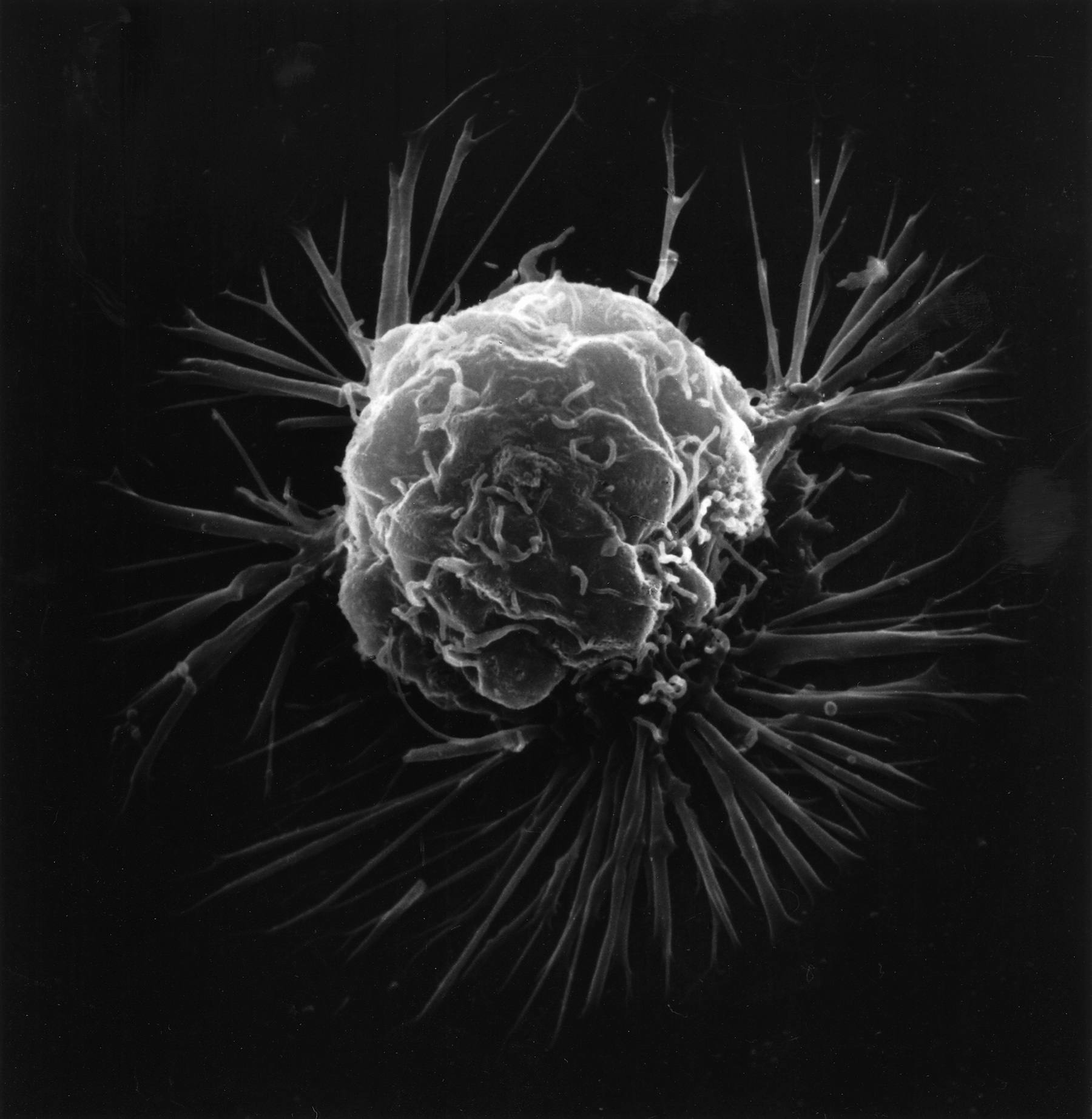 image of a breast cancer cell