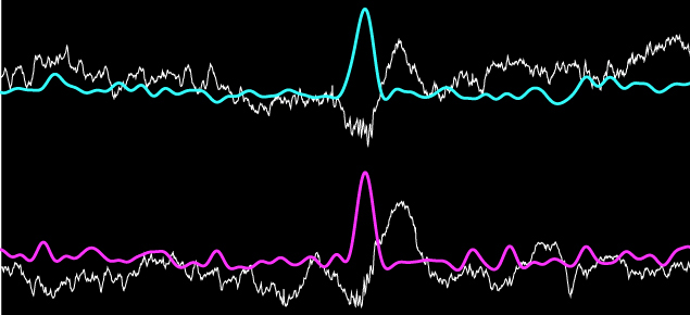 picture of coloured wave forms depicting short-wave ripples in the brain