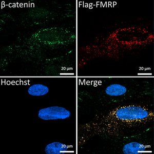composite image showing the localization of b catenin and FMRP